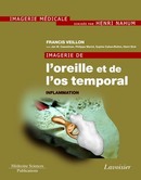 Imagerie de l'oreille et de l'os temporal - Volume 2 : Inflammation  De VEILLON Francis - MEDECINE SCIENCES PUBLICATIONS