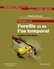 Imagerie de l'oreille et de l'os temporal - Volume 4 : Tumeurs, nerf facial  De VEILLON Francis - MEDECINE SCIENCES PUBLICATIONS