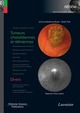 Tumeurs choroïdiennes et rétiniennes / Divers (Coll. Coffret rétine, n°8) De Livia LUMBROSO-LE ROUIC, Sarah TICK et Salomon-Yves COHEN - MEDECINE SCIENCES PUBLICATIONS