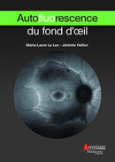 Autofluorescence du fond d'œil (Coll. Ophtalmologie) De Marie-Laure LE LEZ et Jérémie HALFON - MEDECINE SCIENCES PUBLICATIONS