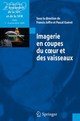 Imagerie en coupes du coeur et des vaisseaux De Pascal GUÉRET et Francis JOFFRE - Springer