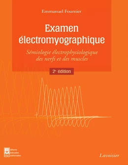 Examen électromyographique