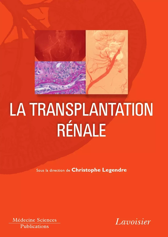 La transplantation rénale - Christophe Legendre - Médecine Sciences Publications