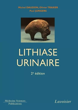 Lithiase urinaire