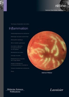 Inflammation (Coll. Coffret rétine, n°4) - Michel WEBER - Médecine Sciences