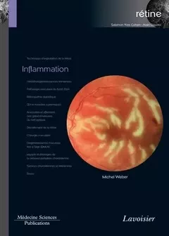 Inflammation - Michel WEBER - Médecine Sciences Publications