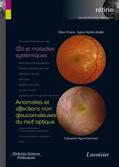 Œil et maladies systémiques / Anomalies et affections non glaucomateuses du nerf optique