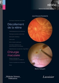 Décollement de la rétine / Chirurgie maculaire (Coll. Coffret rétine, n°6) - Jean-François KOROBELNIK, Ramin TADAYONI - Médecine Sciences