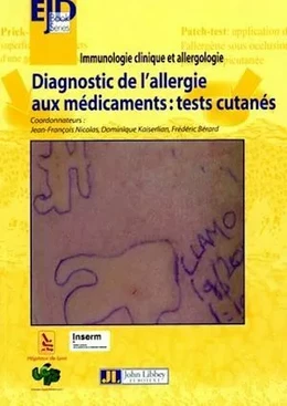 Diagnostic de l'allergie aux médicaments : tests cutanés