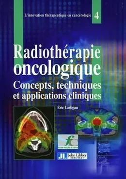 La radiothérapie oncologique