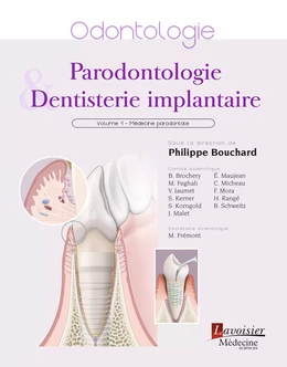 Parodontologie & dentisterie implantaire : Volume 1 : médecine parodontale