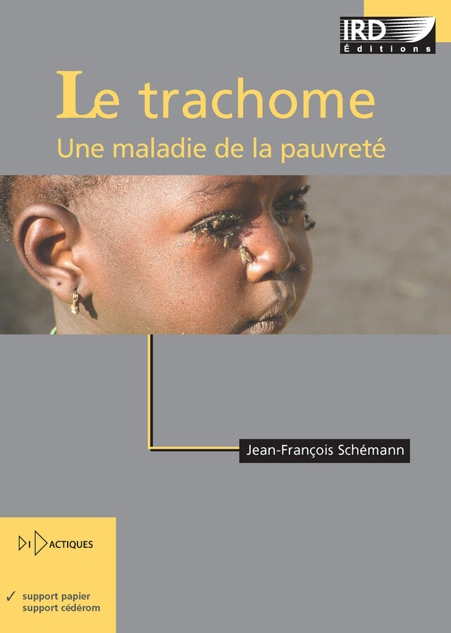 Le trachome - Jean-François Schemann - IRD Éditions
