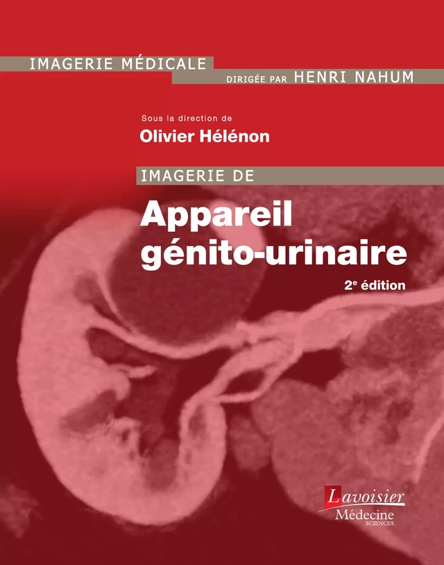 Imagerie de l'appareil génito-urinaire - Olivier Hélénon - Médecine Sciences Publications