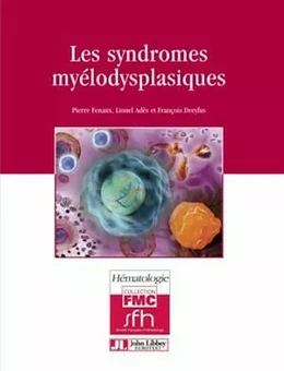 Les syndromes myélodysplasiques