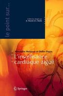 Insuffisance cardiaque aiguë 