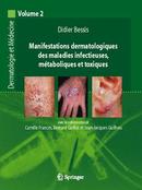 Manifestations dermatologiques des maladies infectieuses, métaboliques et toxiques (Dermatologie et médecine volume 2)