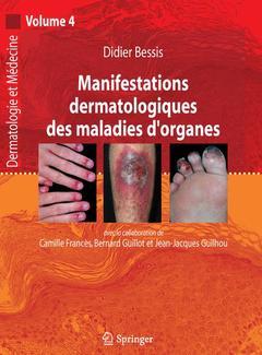 Manifestations dermatologiques des maladies d'organes (Dermatologie et médecine, Vol. 4) - Didier BESSIS - Springer