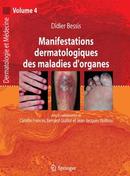 Manifestations dermatologiques des maladies d'organes (Dermatologie et médecine, Vol. 4)