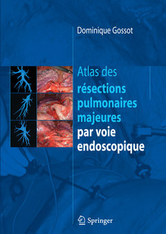 Atlas des résections pulmonaires majeures par voie endoscopique - Dominique GOSSOT - Springer