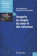 Imagerie en coupes du coeur et des vaisseaux (Compte rendu 4es rencontres de la SFC et de la SFR Paris 24 et 25 mars 2011)