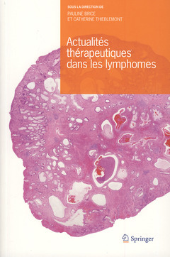 Actualités thérapeutiques dans les lymphomes - Pauline Brice, Catherine THIEBLEMONT - Springer
