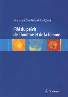 IRM du pelvis de l'homme et de la femme  - Frank BOUDGHÈNE - Springer