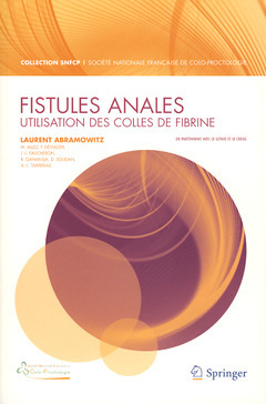 Fistules anales. Utilisation des colles de fibrine - Laurent ABRAMOWITZ - Springer