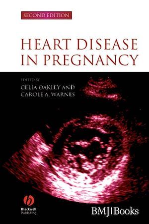 Heart Disease in Pregnancy - Carole A. Warnes, Celia Oakley - BMJ Books