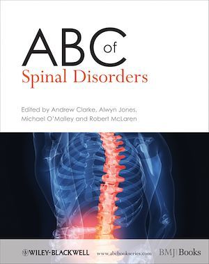 ABC of Spinal Disorders - Andrew Clarke, Alwyn Jones, Michael O'Malley, Robert McLaren - BMJ Books