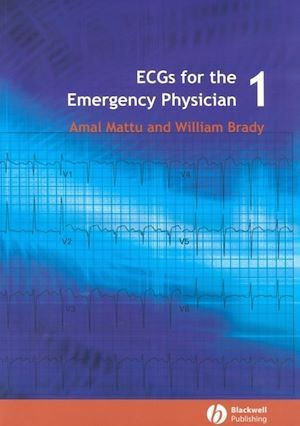 ECGs for the Emergency Physician 1 - Amal Mattu - BMJ Books