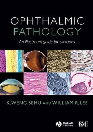 Ophthalmic Pathology - K. Weng Sehu, William R. Lee - BMJ Books