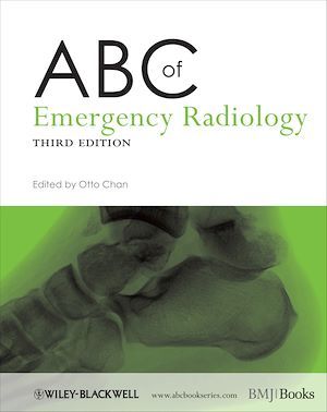 ABC of Emergency Radiology - Otto Chan - BMJ Books
