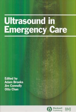 Ultrasound in Emergency Care - Otto Chan, James A. Connolly, Adam J. Brooks - BMJ Books