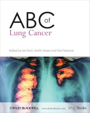 ABC of Lung Cancer - Ian Hunt, Martin M. Muers, Tom Treasure - BMJ Books