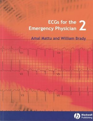 ECGs for the Emergency Physician 2 - Amal Mattu, William J. Brady - BMJ Books
