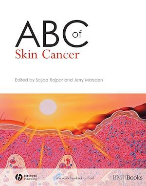 ABC of Skin Cancer - Sajjad Rajpar, Jerry Marsden - BMJ Books