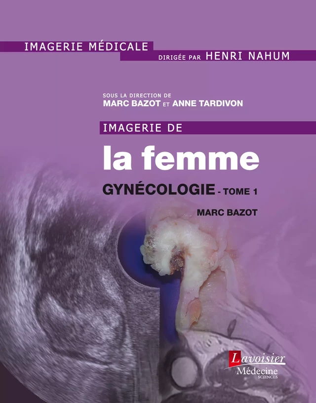 Imagerie de la femme -  - Médecine Sciences Publications