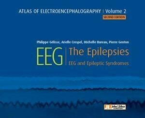 EEG - The Epilepsies - Pierre Genton, Philippe Gélisse, Arielle Crespel, Michelle Bureau - John Libbey