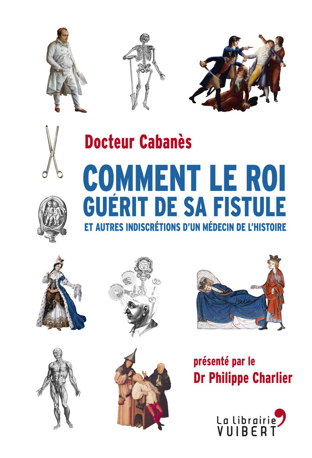 Comment le roi guérit de sa fistule - Augustin Cabanès - La Librairie Vuibert
