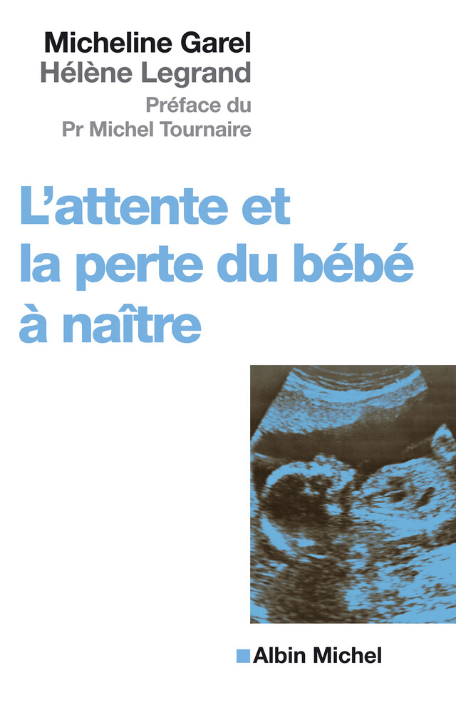 L'Attente et la perte du bébé à naître - Micheline Garel, Hélène Legrand - Albin Michel