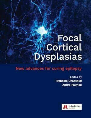 Focal Cortical Dysplasias - Francine Chassoux, Andre Palmini - John Libbey
