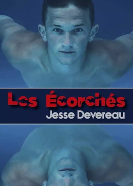 Les Écorchés