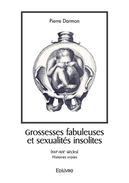 Grossesses fabuleuses et sexualités insolites (XVIe-XIXe siècles)