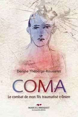 Coma