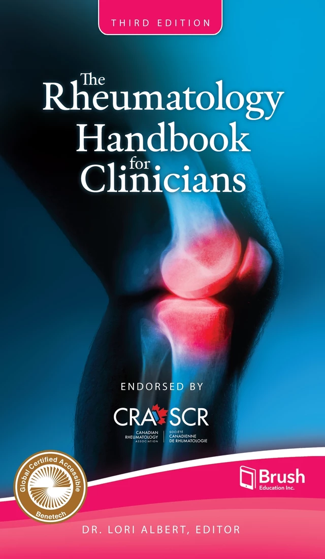 The Rheumatology Handbook for Clinicians - Lori Albert - Brush Education