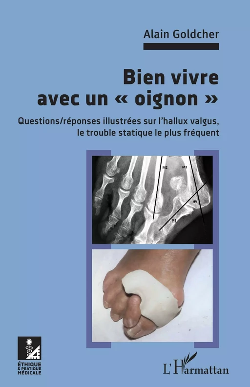 Bien vivre avec un "oignon" - Alain Goldcher - Editions L'Harmattan