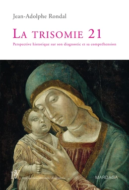 La trisomie 21