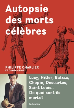 Autopsie des morts célèbres