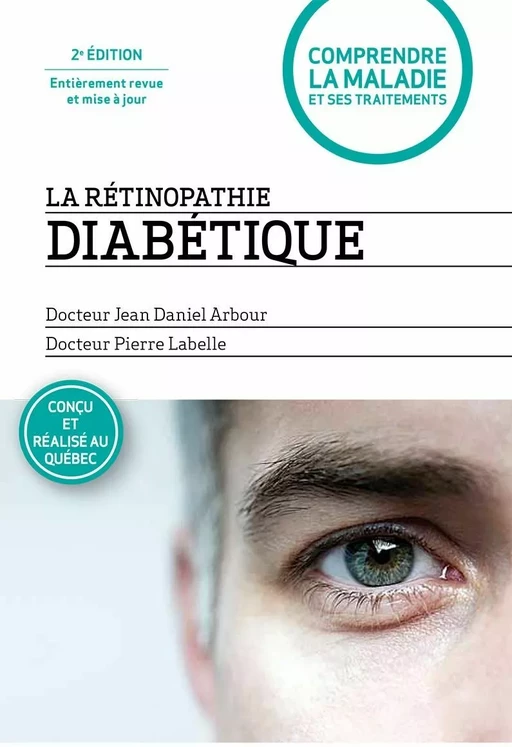 La rétinopathie diabétique - 2e édition entièrement revue et mise à jour - Jean Daniel Arbour, Pierre Labelle - Annika Parance Éditeur