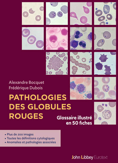 Pathologies des globules rouges - Glossaire illustré en 50 fiches ...